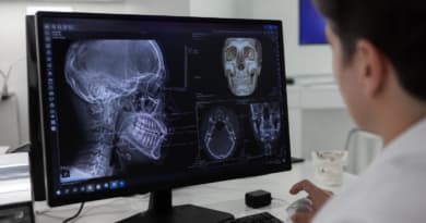 AI in Jaw Surgery: New Bibliometric Study Maps Research Surge and Clinical Potential